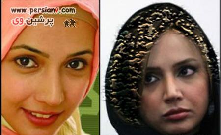 عکس افسانه پاکرو قبل از عمل