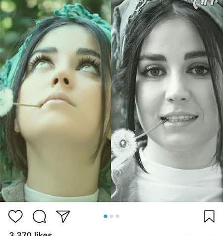 عکس افسانه پاکرو قبل از عمل