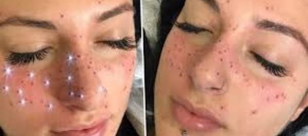 عکس صورت خال خالی