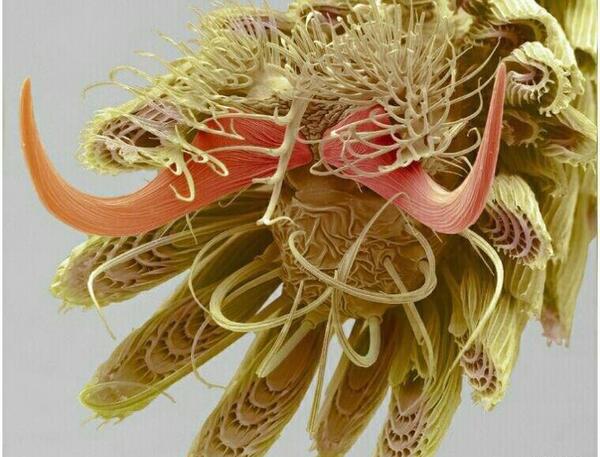 عکس پشه زیر میکروسکوپ