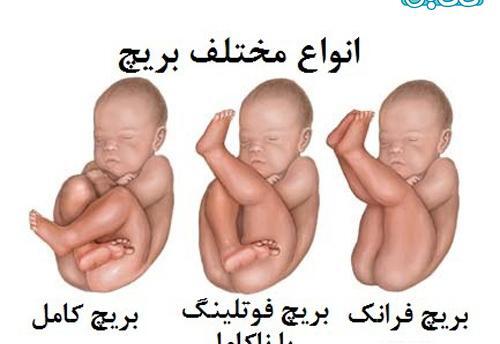 عکس جنین نشسته