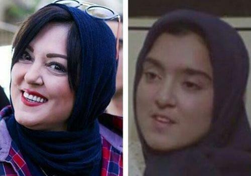 عکس پرستو صالحی قبل از عمل