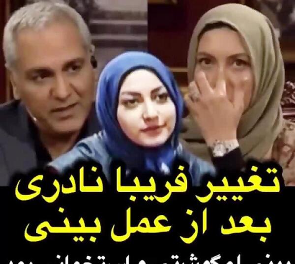 عکس فریبا نادری بعد از عمل
