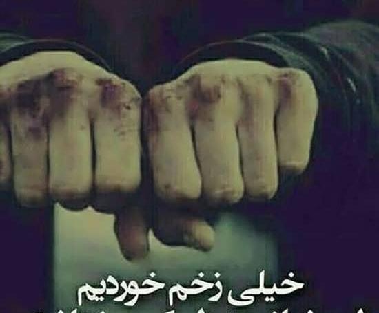 عکس پروفایل دختر زخمی