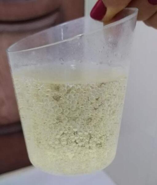 عکس بچه سرکه