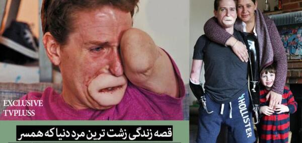 دانلود عکس زشت ترین مرد دنیا