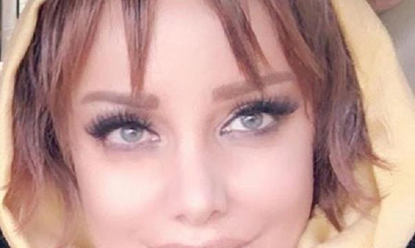 عکس شراره رخام بعد از عمل زیبایی