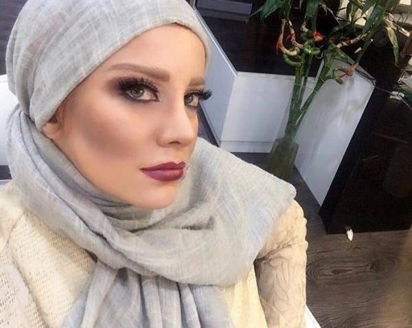 عکس شراره رخام بعد از عمل زیبایی