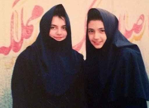 عکس شبنم قلی خانی قبل از عمل