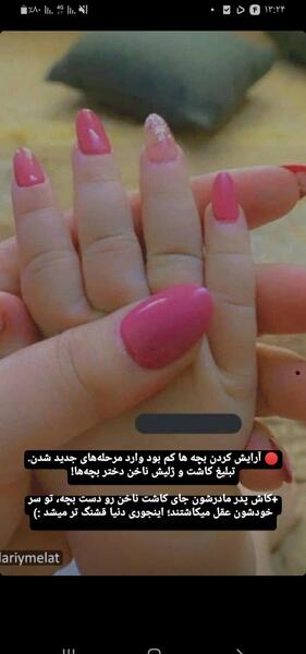 عکس تبلیغاتی کاشت ناخن