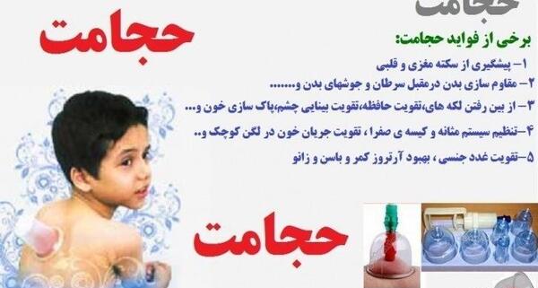 عکس و تصویر نقاط حجامت