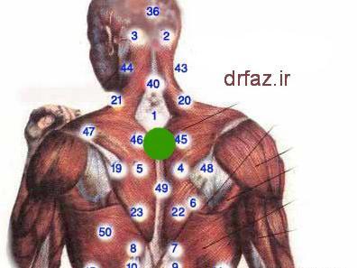 عکس و تصویر نقاط حجامت