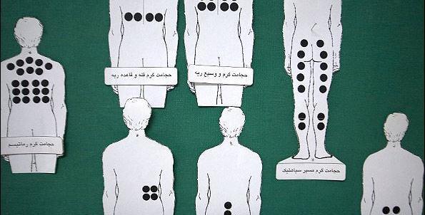 عکس و تصویر نقاط حجامت