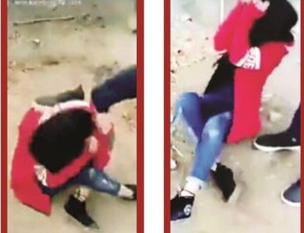 اینستاگرام عکس صورت دختری که در سیرجان کتک خورد