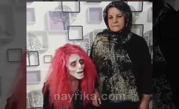 عکس رکسانا قبل از عمل