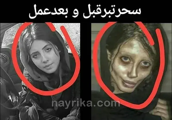عکس رکسانا قبل از عمل