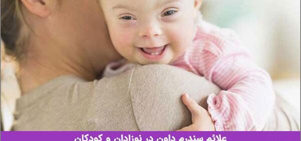 عکس نوزاد سندرومی
