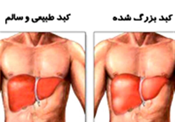 عکس واقعی طحال