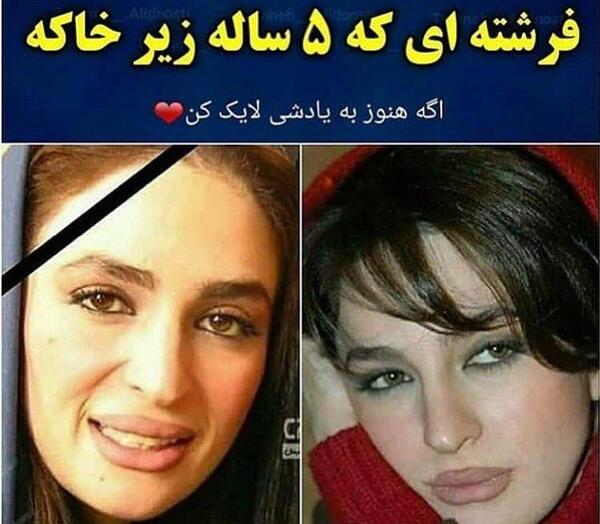 عکس عسل بدیعی قبل از عمل زیبایی