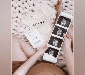 ایده برای عکس سونو