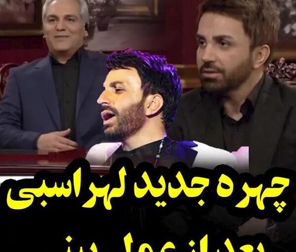عکس شاهرخ استخری قبل عمل بینی