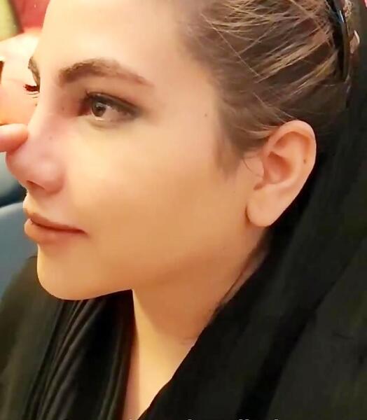 عکس نیکا فلاحی قبل عمل و بعد عمل