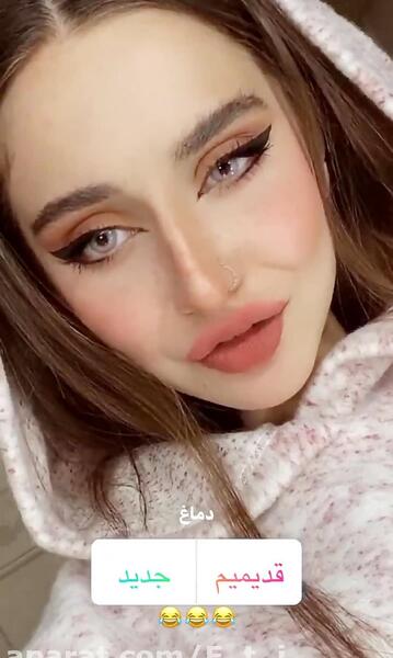 عکس نیکا فلاحی قبل عمل و بعد عمل