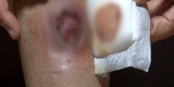عکس زامبی پرسپولیسی
