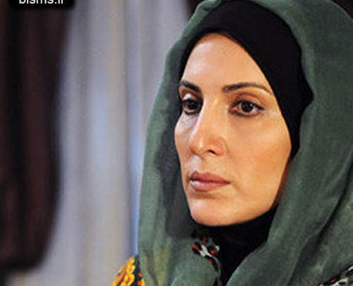 عکس فاطمه گودرزی قبل عمل
