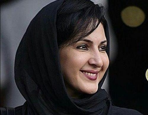 عکس فاطمه گودرزی قبل عمل