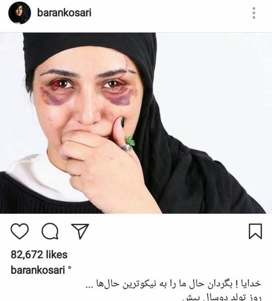 عکسهای باران کوثری بعد از تصادف