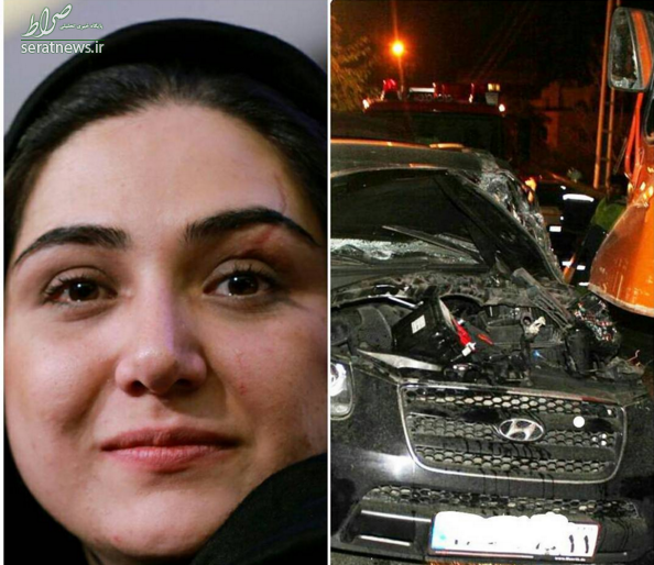 عکسهای باران کوثری بعد از تصادف