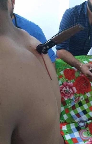 عکس زن چاقو خورده