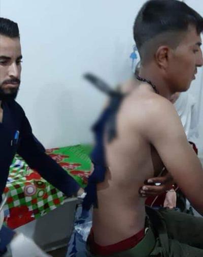 عکس زن چاقو خورده