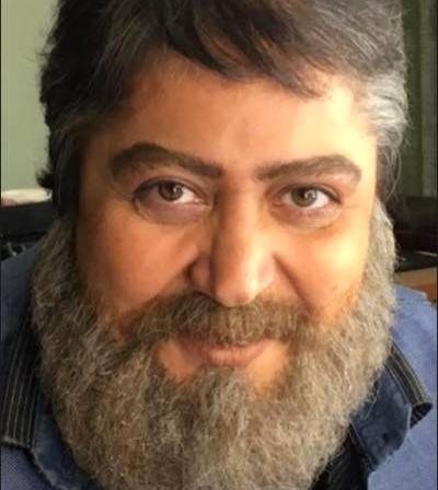 عکسهای شهره لرستانی بعد از تغییر جنسیت