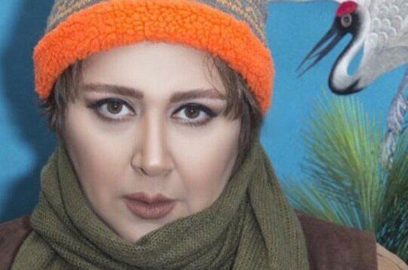 عکسهای شهره لرستانی بعد از تغییر جنسیت