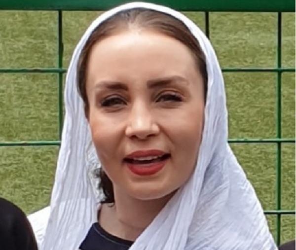 عکس حدیث فولادوند قبل از عمل زیبایی