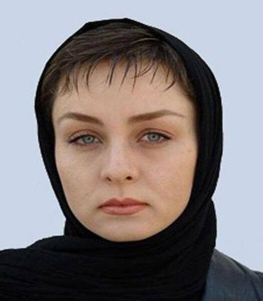 عکس حدیث فولادوند قبل از عمل زیبایی
