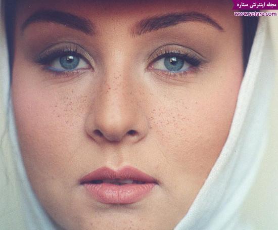 عکس حدیث فولادوند قبل از عمل زیبایی