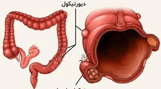 عکس داخل شکم انسان