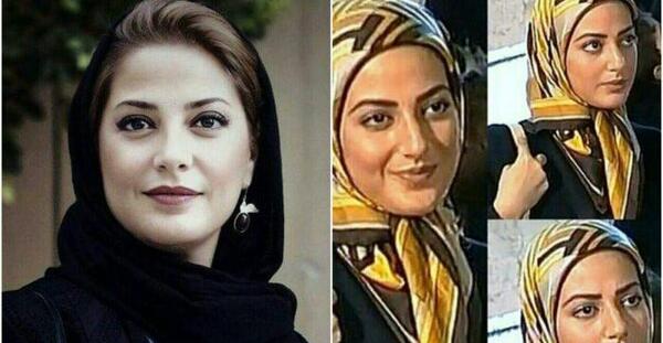 عکس طناز طباطبایی قبل
