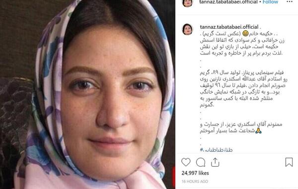 عکس طناز طباطبایی قبل