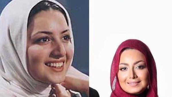 عکس شیلا خداداد قبل از عمل زیبایی