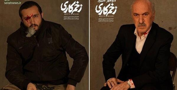 عکس سید جواد هاشمی در زخم کاری