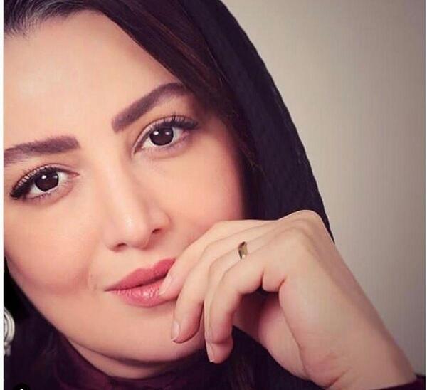 عکس لب شیلا خداداد
