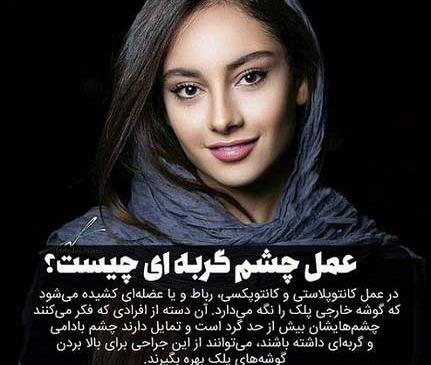 عکس چشم های ترلان پروانه
