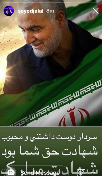عکس صورت حاج قاسم سلیمانی بعد از شهادت