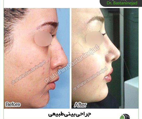 عکس مدل های دماغ عملی