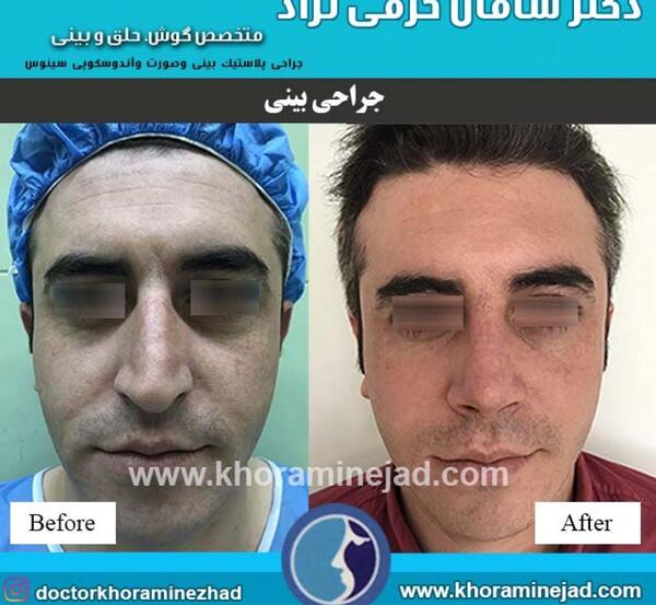 عکس مدل های دماغ عملی