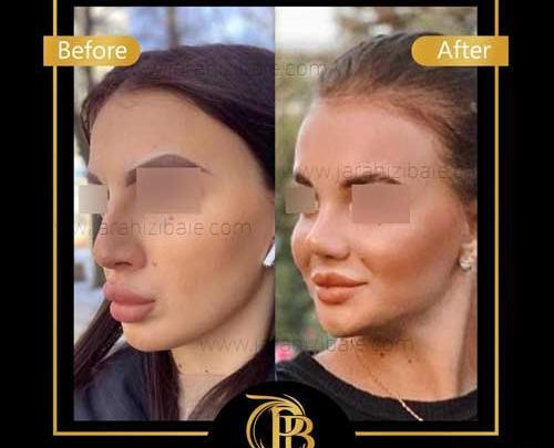 عکس مدل های دماغ عملی